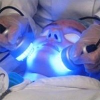 acne light therapy